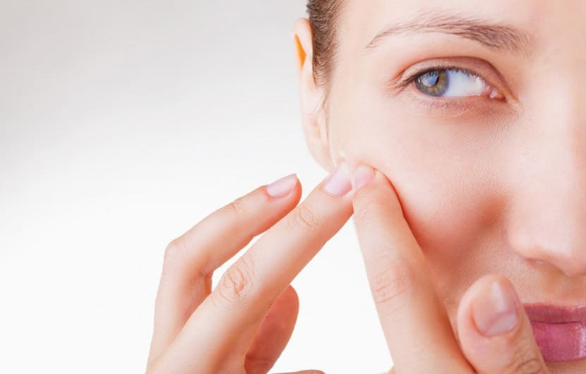 راهکارهای درمان خانگی برای جوش صورت